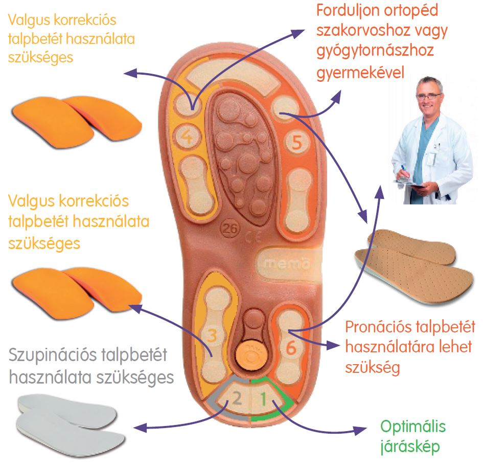 memo mukodes pronacioval | Hétmérföldes Supinált Gyerekcipő Webáruház Diagnosztikai talp segít a betét kiválasztásában